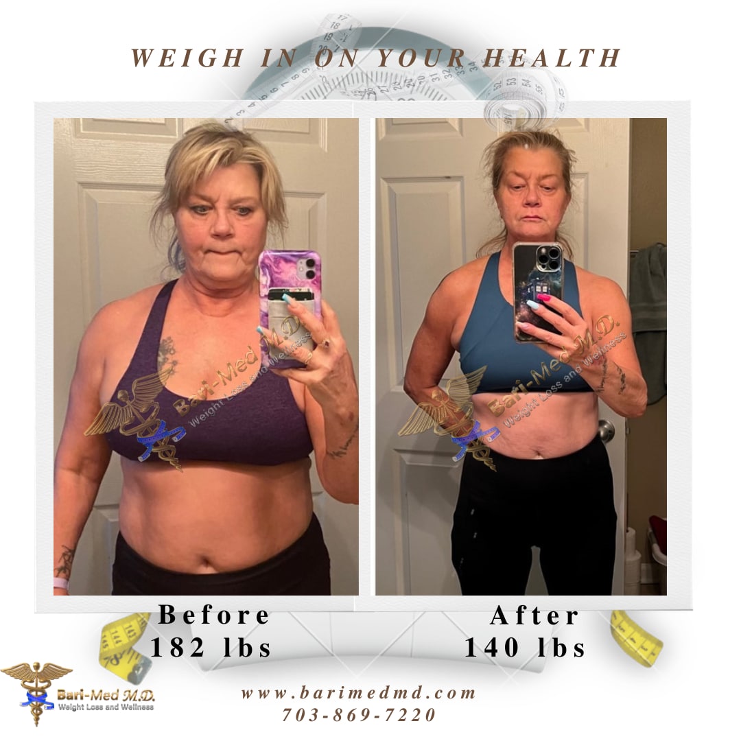 A woman is in the mirror and before and after her weight loss.