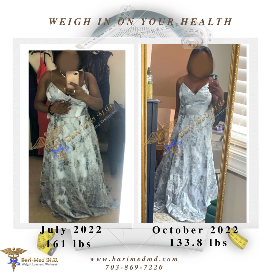 A woman in a dress is before and after weight loss.