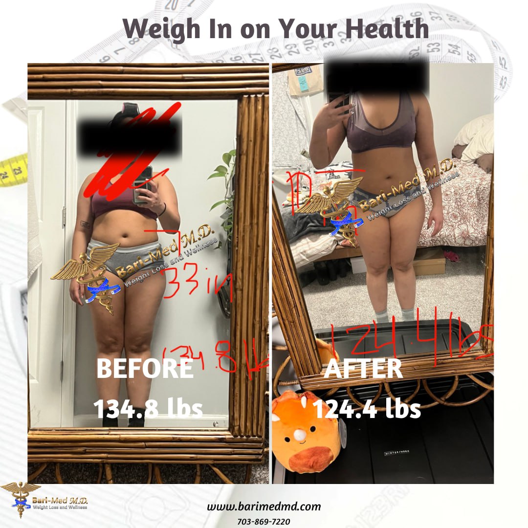 A woman 's body in the mirror before and after weight loss.