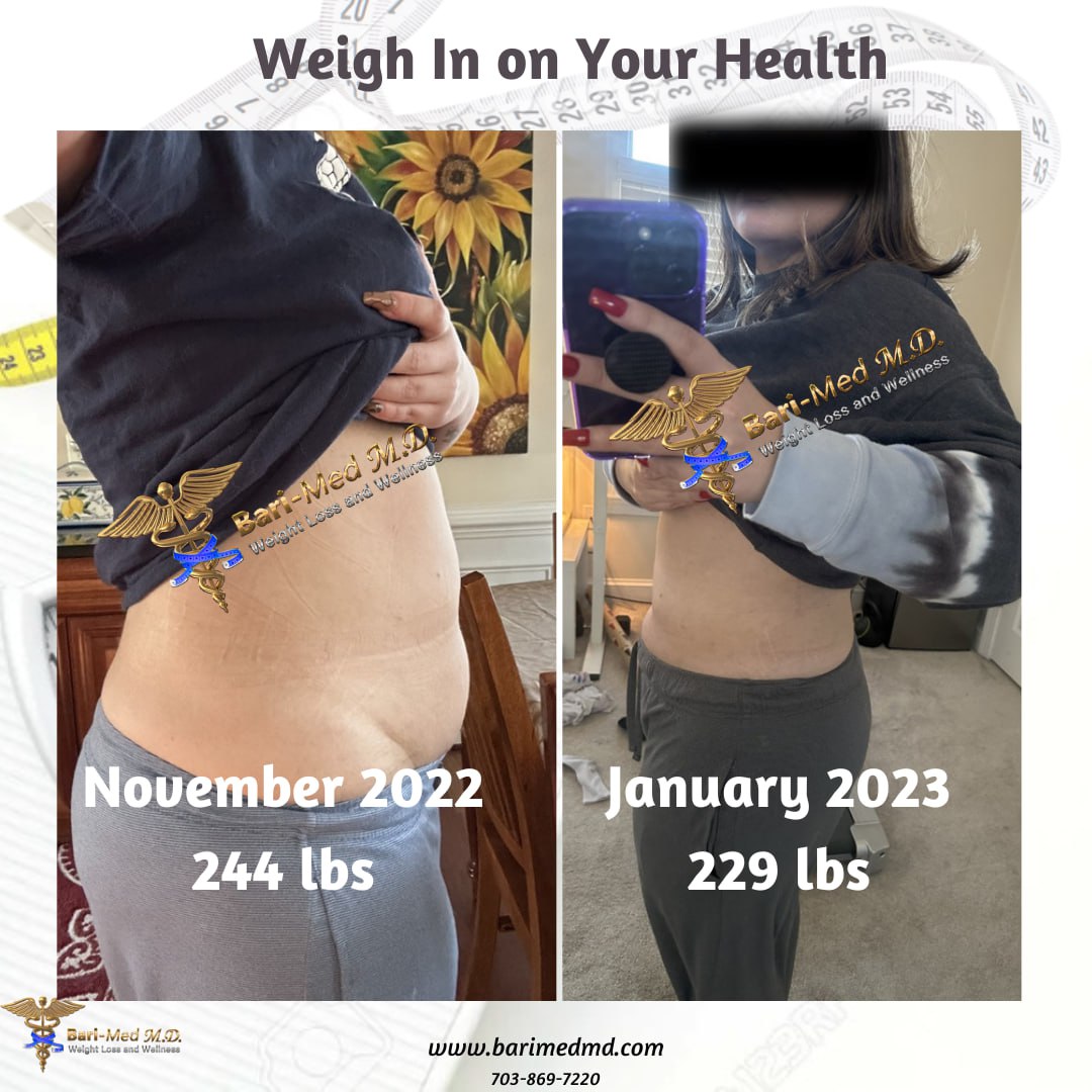 A woman is taking a picture of her weight loss progress.