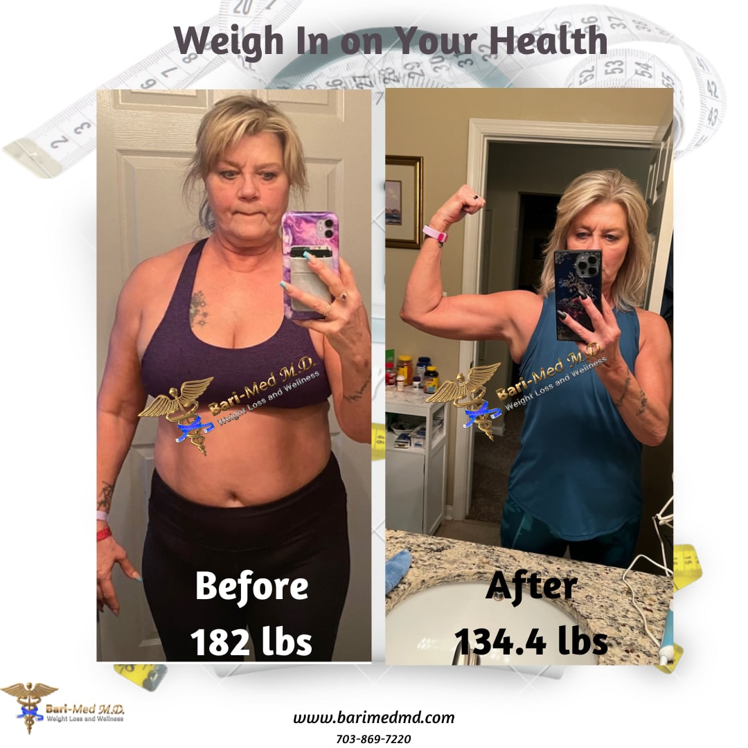 Reviews - Weight Loss Outcomes - Bari-Med M.D. Weight Loss & Wellness