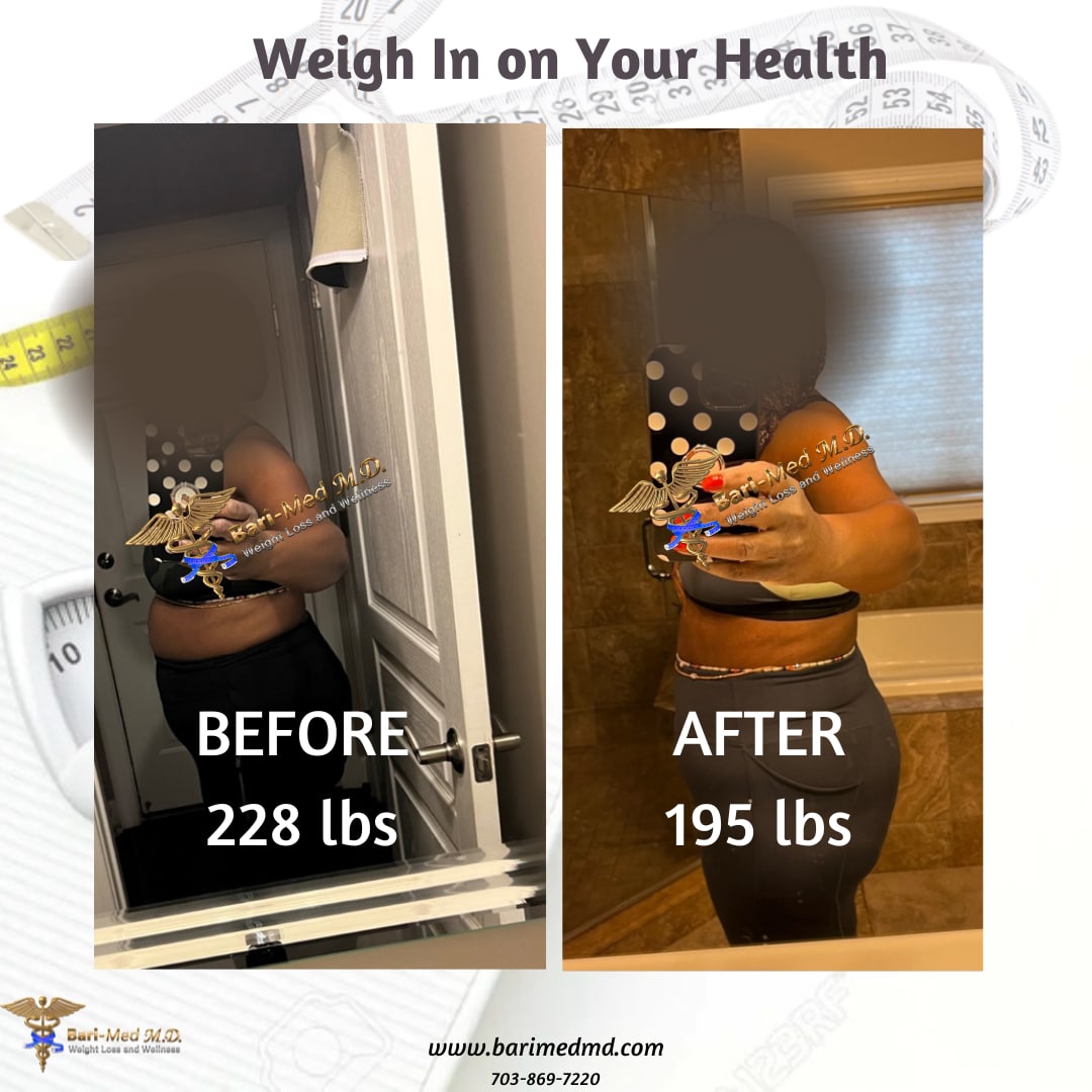 A woman is in the mirror and before and after weight loss.