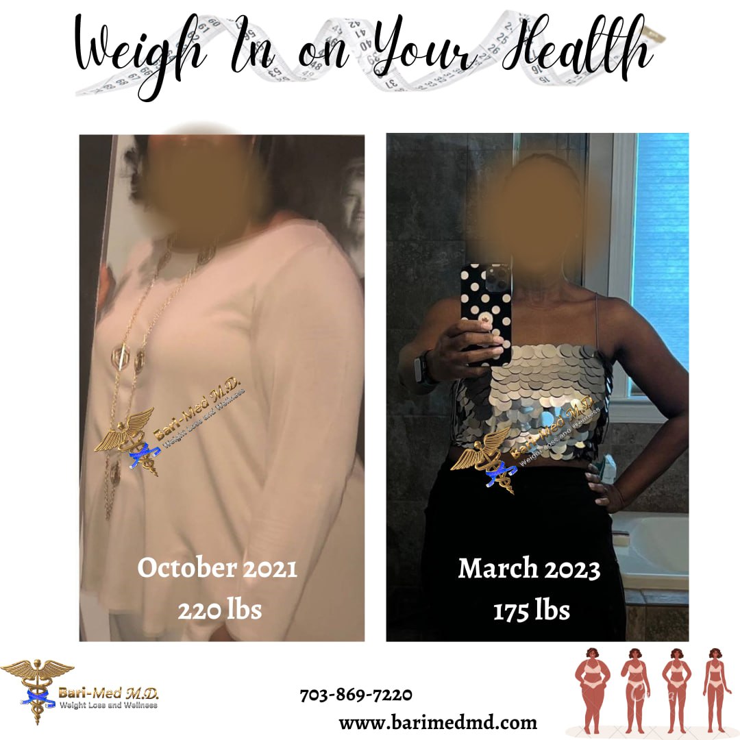 A woman 's weight in on her health and before and after photos.