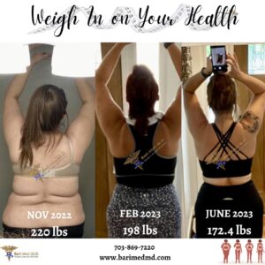 A woman is in three different stages of her weight loss.