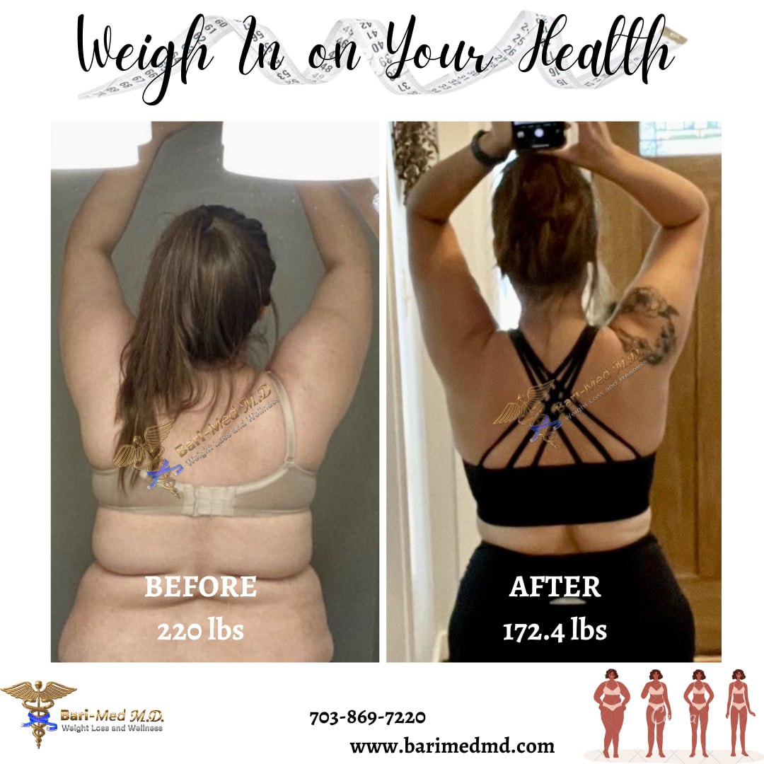 Reviews - Weight Loss Outcomes - Bari-Med M.D. Weight Loss & Wellness