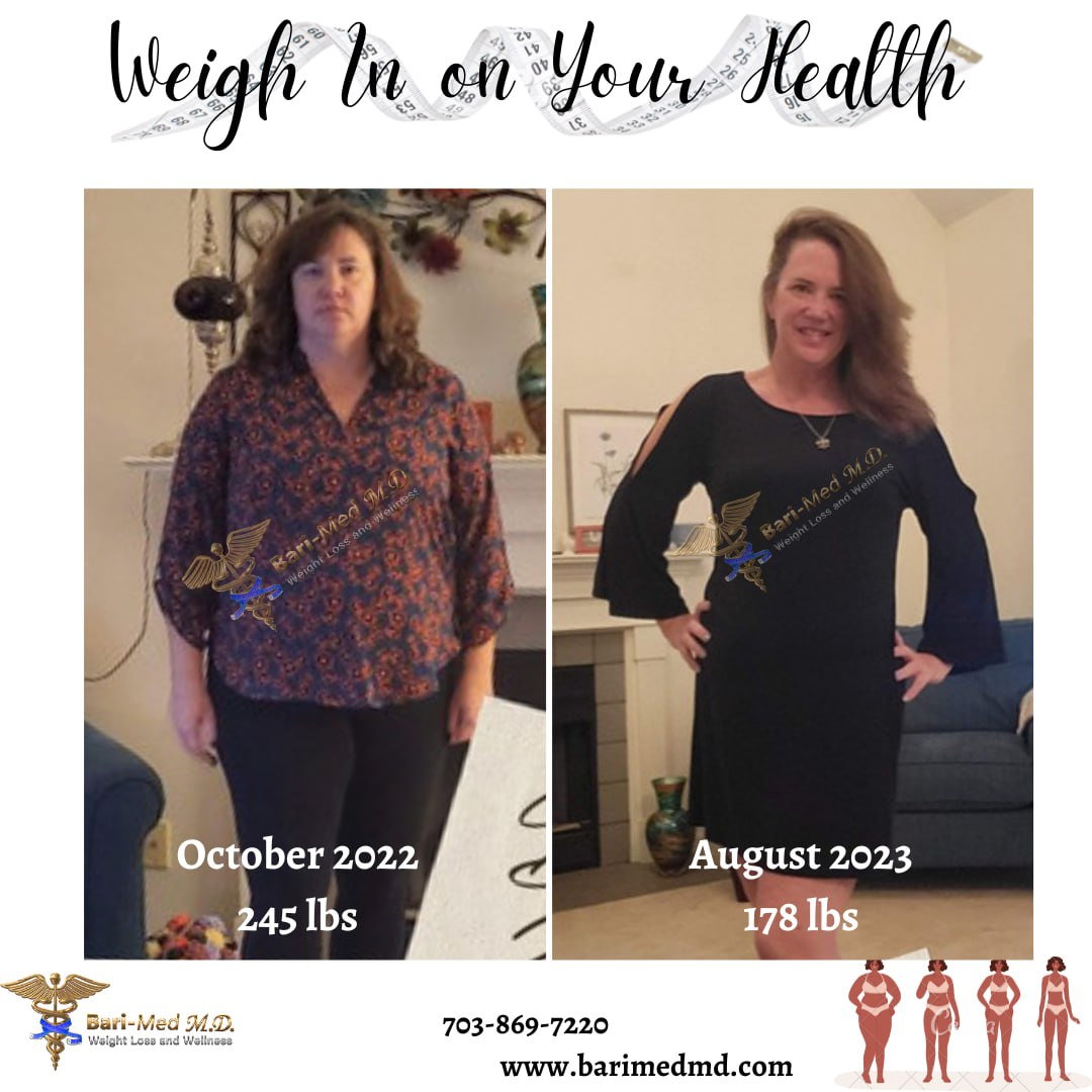 Reviews - Weight Loss Outcomes - Bari-Med M.D. Weight Loss & Wellness