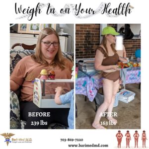 A woman is shown before and after her weight loss.