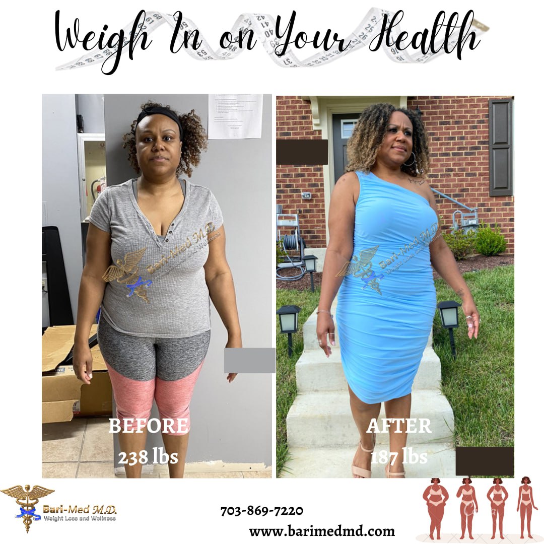 Reviews - Weight Loss Outcomes - Bari-Med M.D. Weight Loss & Wellness
